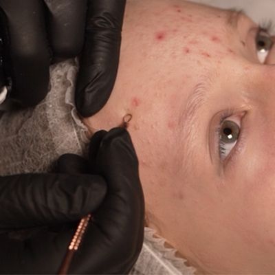 Klasikinis veido valymas