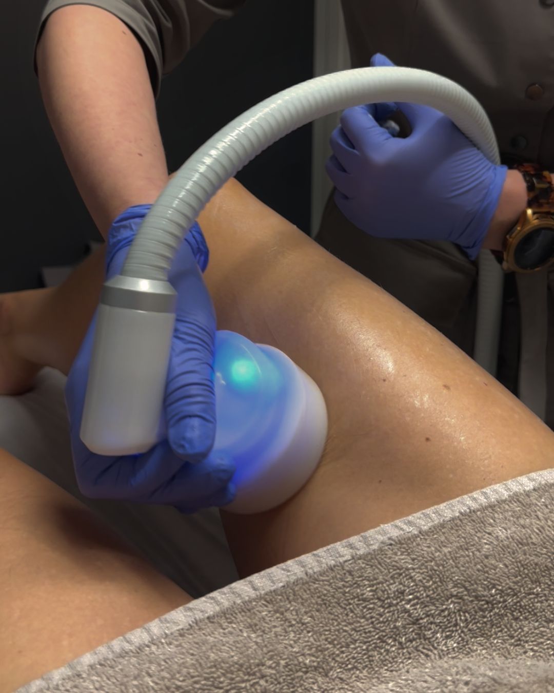  CRYO T SHOCK | Kojos