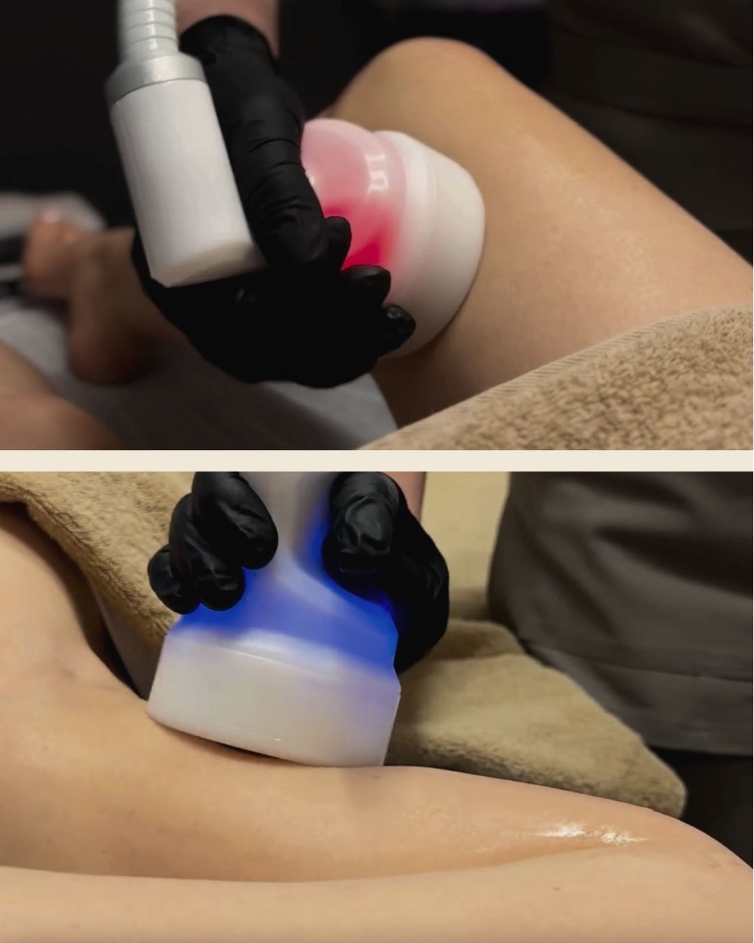 CRYO T SHOCK | Nugara - šonai